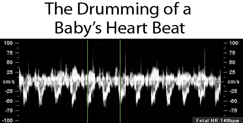 Baby's Heart Beat
