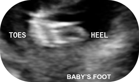 Baby Boy's Foot and Toes